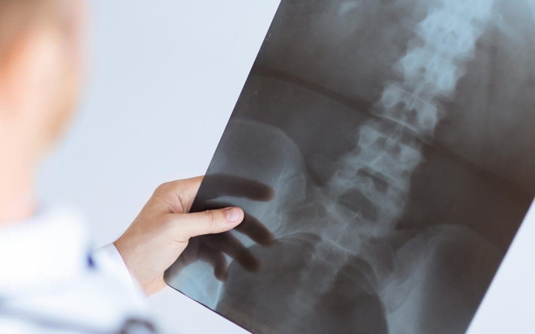 What Types of Injuries Are Covered by DBA Insurance?