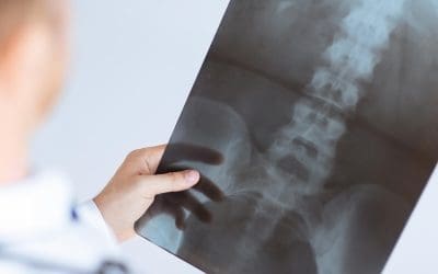 What Types of Injuries Are Covered by DBA Insurance?