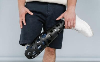 Understanding Loss of Limb Compensation Under the Defense Base Act (DBA)